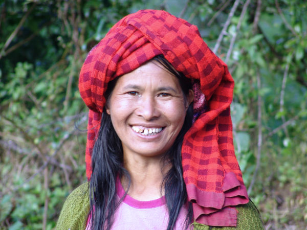 Femme édentée souriant