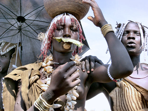 Cicatrisation après pose d'un labret